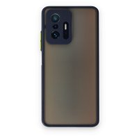 Newface Xiaomi Mi 11T Kılıf Montreal Silikon Kapak - Lacivert