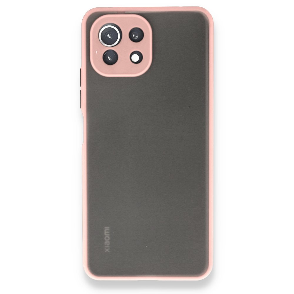 Newface Xiaomi Mİ 11 Lite Kılıf Montreal Silikon Kapak - Pembe