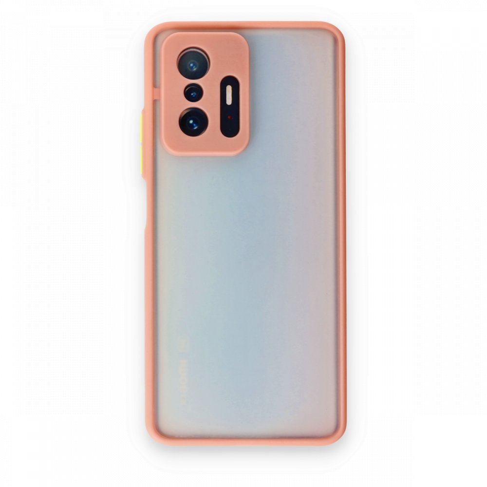 Newface Xiaomi Mi 11T Pro Kılıf Montreal Silikon Kapak - Pembe