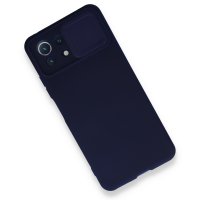 Newface Xiaomi Mİ 11 Lite Kılıf Color Lens Silikon - Lacivert