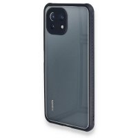 Newface Xiaomi Mİ 11 Lite Kılıf Miami Şeffaf Silikon - Lacivert