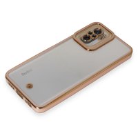 Newface Xiaomi Poco M5s Kılıf Liva Lens Silikon - Pudra