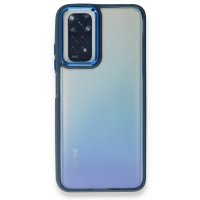 Newface Xiaomi Redmi Note 11 Kılıf Dora Kapak - Mavi