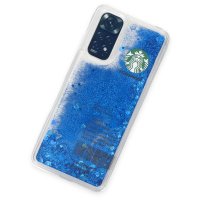 Newface Xiaomi Redmi Note 11 Kılıf Starbuck Sulu Silikon - Mavi