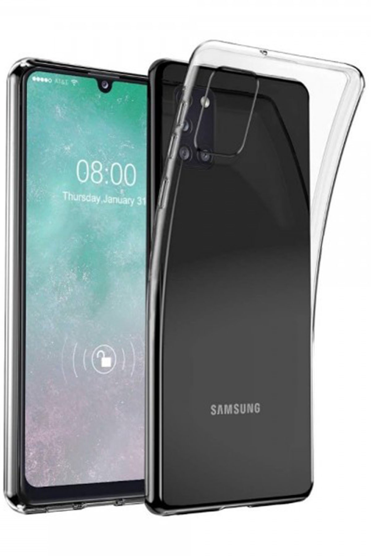 Newface Samsung Galaxy A31 Kılıf Zegna Yüzüklü Silikon Kapak - Koyu Yeşil